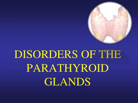 PPT - DISORDERS OF THE PARATHYROID GLANDS PowerPoint Presentation, free ...