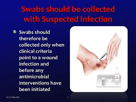 Wound Swabs basics