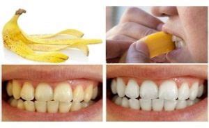 How to Whiten Teeth with Banana Peel: Step By Step Guide