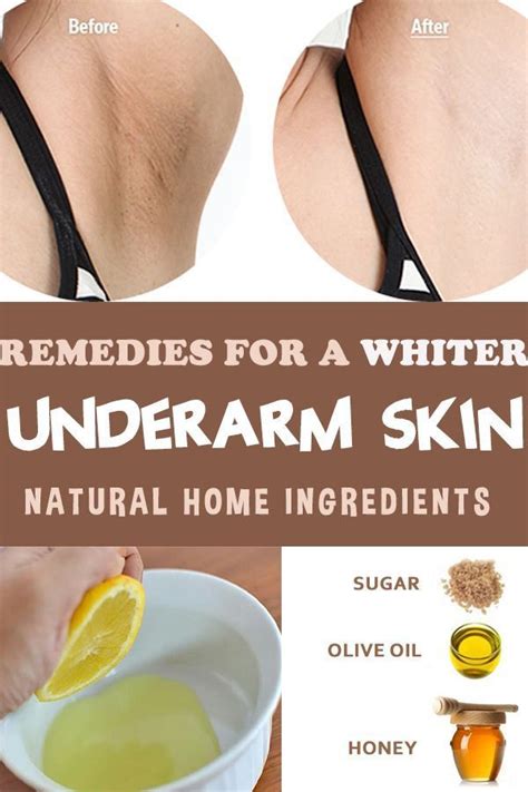 5 Best Home Remedies For Dark Underarms | Wrytin