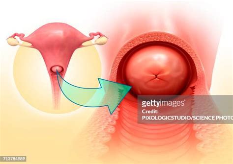 Cervix Image Photos and Premium High Res Pictures - Getty Images