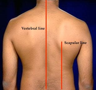 midsternal line a vertical line down the middle of sternum parasternal line a vertical line ...