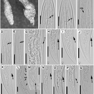 Line drawings of Longidorus macrodorus sp. nov., female paratypes, male... | Download Scientific ...