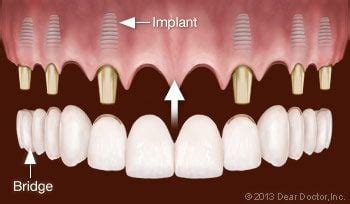 Patient Education - Dentist Woodbridge, VA - Dental Education Library