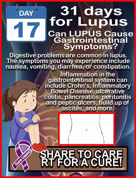 31 Days For Lupus! May is #LUPUSAwarenessMonth!! | Lupus, Lupus facts, Lupus symptoms