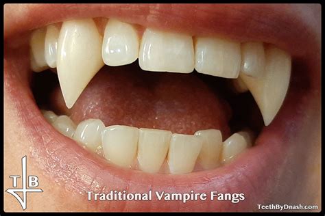 Vampire Teeth By Pickypikachu Vampire Teeth Vampire T - vrogue.co