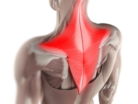 Csuklyásizom (trapezius) fájdalom – mi állhat a háttérben?