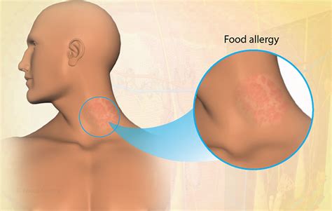 Health Condition : Symptoms, Causes, Treatment and More