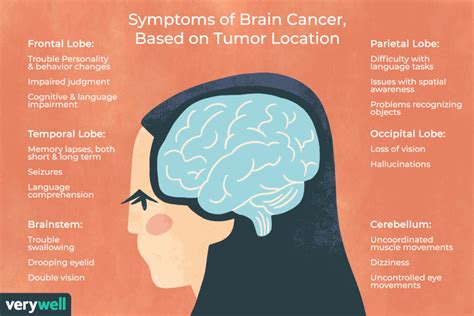 Brain Cancer Overview and More