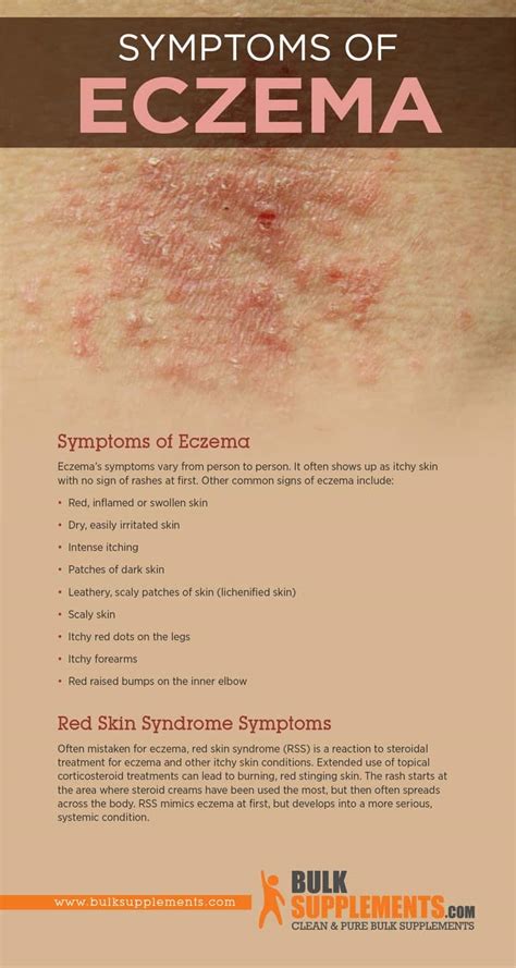 Eczema Rash How Do You Get It at George Bartolome blog