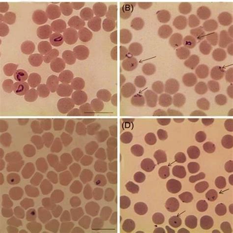 Light micrographs of Babesia bovis and Babesia bigemina treated with 50 ...