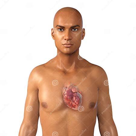 Human Heart Anatomy, 3D Illustration. Concept of Heart Disease. Coronary Artery Disease ...
