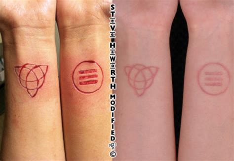 Share more than 71 laser branding tattoo super hot - in.coedo.com.vn