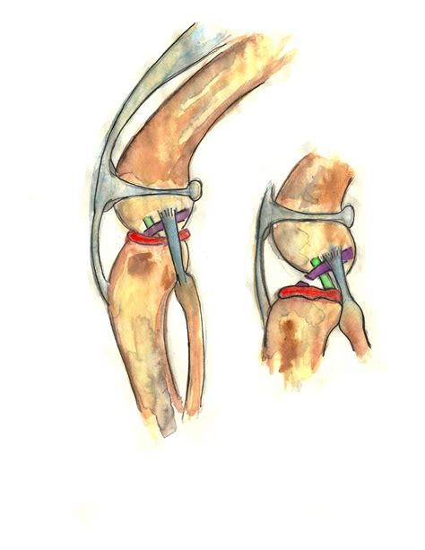 Cranial Cruciate Ligament Repair: Is Surgery Right For My Dog?