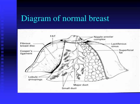 PPT - Breast Pathology PowerPoint Presentation, free download - ID:4750342