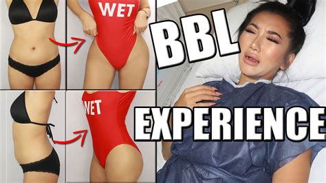 BRAZILIAN BUTT LIFT (BBL) SURGERY EXPERIENCE VLOG | ELITE AFTERCARE - YouTube