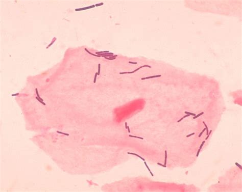 Lactobacillus - Wikipedia