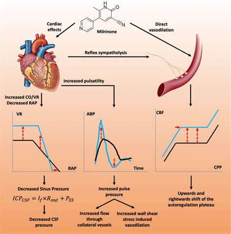 The effect of milrinone on haemodynamics. Milrinone produces ...