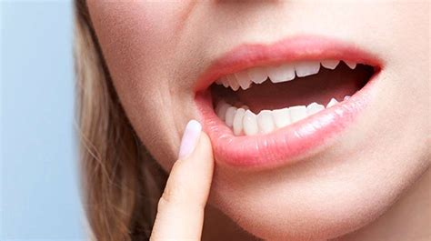 Swollen Gums: Possible Causes and Treatments - Solar Dental & Orthodontics