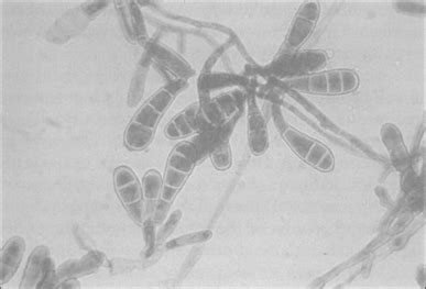 2: Epidermophyton floccosum | Download Scientific Diagram