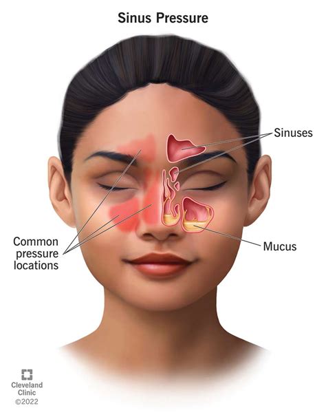 Sinus Pressure: Causes and How To Find Relief