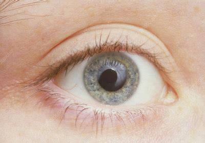 Human eye showing dilated pupil - Stock Image - P420/0002 - Science Photo Library