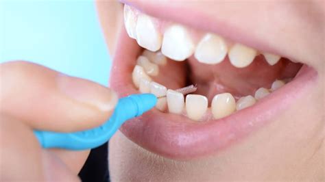 Is Flossing Hard? Interdental Toothbrushes May Be The Answer