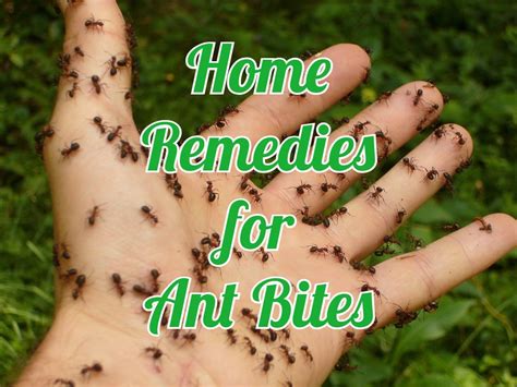 18 Useful Home Remedies For Ant Bites