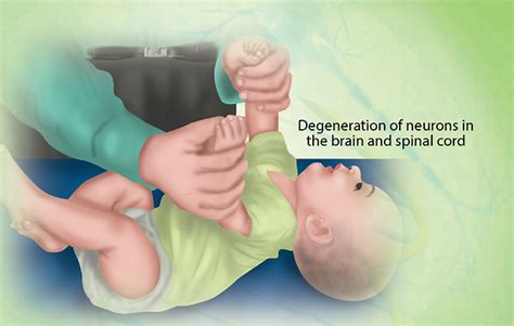 Health Condition : Symptoms, Causes, Treatment and More