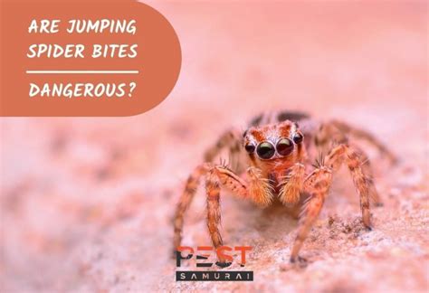 Jumping Spider Bite: Are Jumping Spider Bites Dangerous? - Pest Samurai