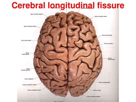 PPT - Cerebral longitudinal fissure PowerPoint Presentation, free download - ID:9433518