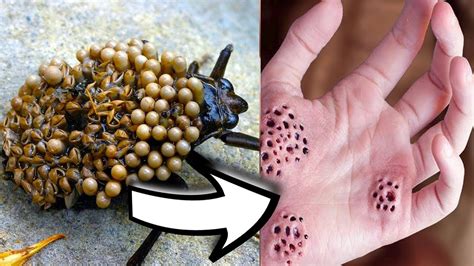 15 Most Dangerous Bugs and Insects - YouTube