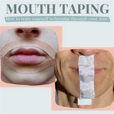 How To Mouth Tape - Family Dental Centre