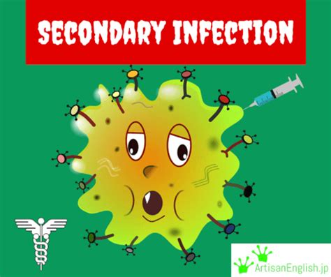 Secondary infection の意味 |使い方 | ArtisanEnglish.jp | ネイティブ