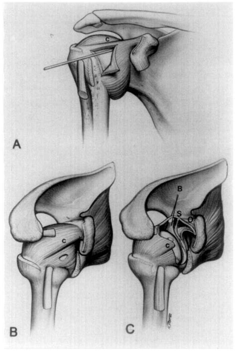 Structure of coracohumeral ligament | Semantic Scholar