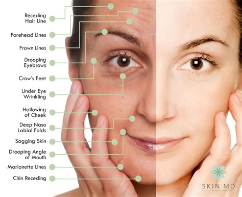 The Anatomy of an Aging Face — Skin MD - Dermatologist in Ortigas, Pasig