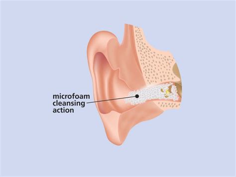Ear Care Education | Debrox