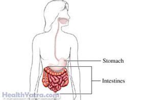 Ischemic Bowel Disease Definition, Causes, Symptoms, Complications and Cost Surgery Treatment ...