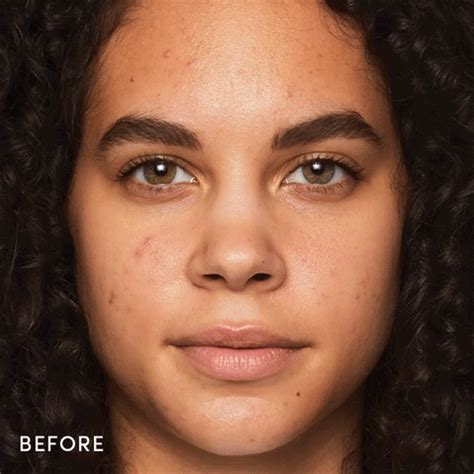 Best Makeup For Acne Prone Skin: Tips & FAQs | WegMart
