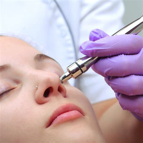 Microdermabrasion - DRV Skin