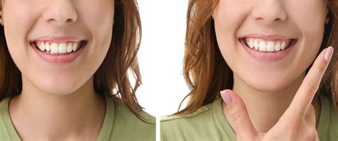 periodontal-surgery – Southeastern Dental Center