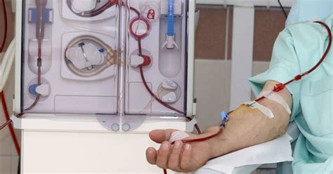 Dialysis: Procedure, purpose, types, side effects, and more