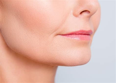 Cheekbone Reconstruction - Northland Plastic Surgery