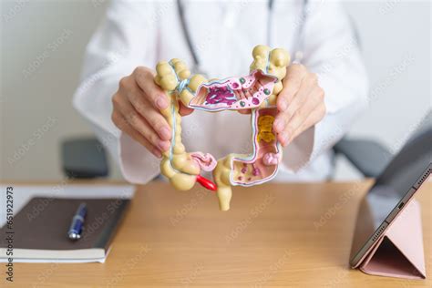 Doctor with human Colon anatomy model and tablet. Colonic disease ...