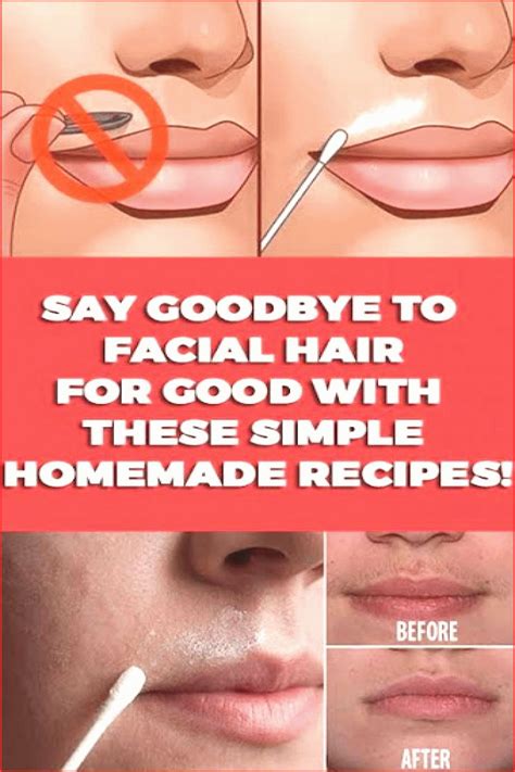 Say Goodbye To Facial Hair For Good With These Simple Homemade Recipes | Unwanted hair removal ...