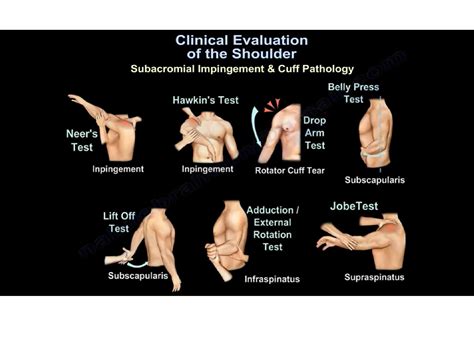 Clinical Evaluation of the Shoulder — OrthopaedicPrinciples.com