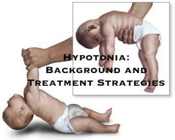 Hypotonia in Children: Physical Therapy Treatment