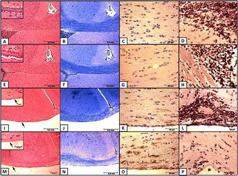 Histological brain sections through the corpus callosum region stained... | Download Scientific ...