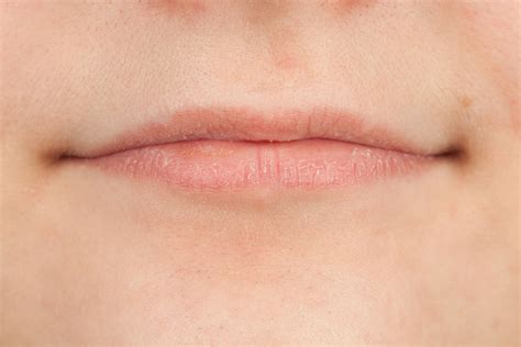 Sunburned Lips: Symptoms, Treatment, and Prevention Methods