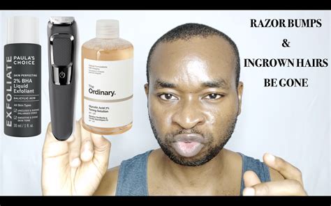 How I Prevent and Get Rid of Razor Bumps – Ingrown Hairs